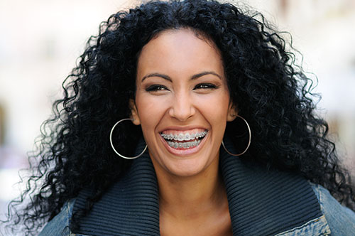 Young Black Woman Smiling with Braces